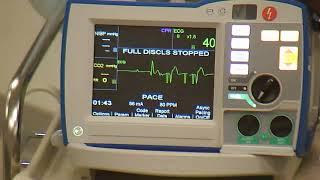 R Series Plus:  Transcutaneous Pacing