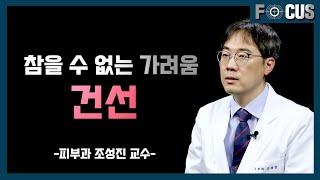 (eng) 건선 때문에 힘들다면 확인하세요 | 피부과 조성진 교수 If you are suffering from psoriasis, please get it checked out