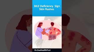 skin rashes