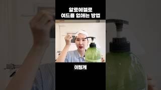 여드름 없애는 가성비 홈케어 #피지제거 #피부열 #알로에젤