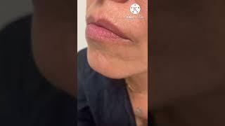 Collagenil(Re-Pulp)balsamo labbra effetto plumping|Queen of fashion CREMI️