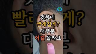 귓불에 빨래집게?효과 있습니다 #건강꿀팁 #중년건강 #귓불빨래집게 #귀지압 #naturalhealthtips