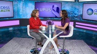 Living with Lupus: Managing Your Lupus with Confidence | Access Health