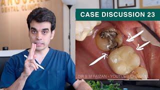 Food Impaction - Case Discussion 23