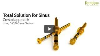 Total Solution for Sinus (Crestal approach)