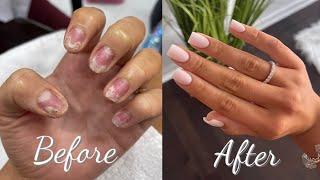 HOW I RUINED MY NATURAL NAILS  + HOW I GREW THEM OUT 