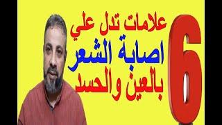 6 علامات تدل علي اصابة الشعر بالعين والحسد | اسماعيل الجعبيري
