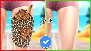 ASMR Remove Dog Ticks & Giant Maggot Infected From Leg | Severely Injured Treatment Animation