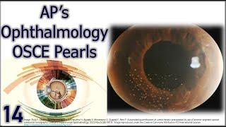 AP's Ophthalmology OSCE Pearls 14