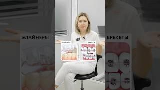 Брекеты VS Элайнеры #брекеты #элайнеры #прикус #ортодонтия #ортодонтмосква #ортодонт