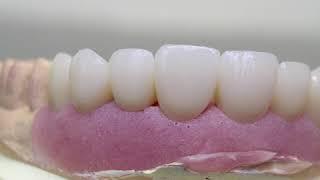 Acidity and Teeth - Dr Walid Zalaket Beirut Lebanon