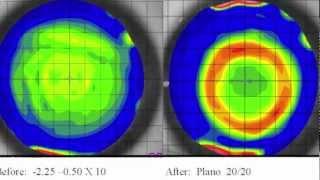 OAA Fundamentals of Orthokeratology Workshop - GSLS2013
