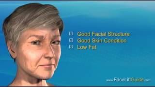 What is a Facelift?