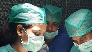 Live Graft Implantation with "No Root Touch" Technique at Care Well Medical Centre Delhi