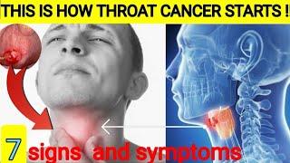 7 signs and symptoms of throat cancer|Thyroat cancer symptoms |Neck cancer|Medicine