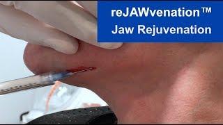 reJAWvenation™ (Jaw Rejuvenation) by Steven F. Weiner, MD