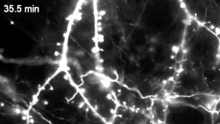 Actin motility in dendritic spines