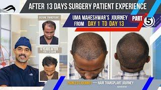 Hair Transplant In Bangalore | Best Center  Cost & Clinic Of Hair Transplant In Bangalore