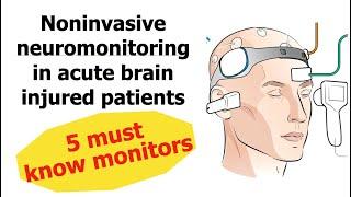 5 Noninvasive neuromonitoring in Neuro ICU: That you must know