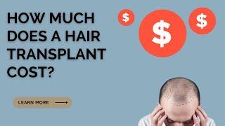 How Much Does a Hair Transplant Cost in Toronto?