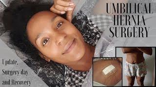 UMBILICAL HERNIA SURGERY || UPDATE AND PICTURES