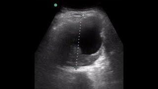 #POCUSSaves Webinar - POCUS in Everyday clinical practice #POCUS