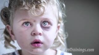 Recognition of Child Abuse and Neglect (Training Video)