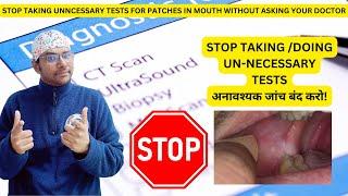 Dr Rudra Mohan | STOP TAKING UNNECESSARY TESTS FOR WHITE PATCHES IN MOUTH WITHOUT ASKING THE DOCTOR!