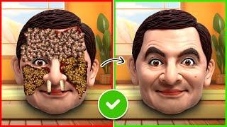 ASMR Remove Kendrick Ticks And Maggots From Mr Bean | Severely Injured Treatment Animation