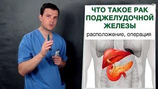 Что такое рак поджелудочной железы. Врач-онколог Владимир Лядов