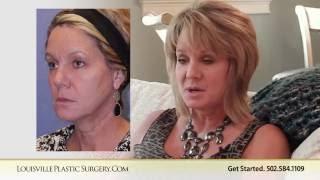 Injectables liquid facelift lisa choosing Dr   O'Daniel