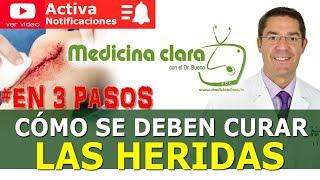 CURAR HERIDAS 🩸 3 PASOS SENCILLOS ‍️ ¿Dejar herida tapada o al aire? | Medicina Clara