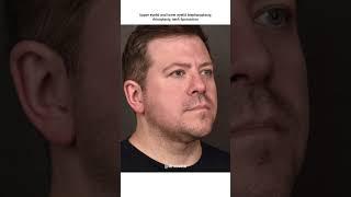 ⁠Global facial refresh with a combination of plastic surgery procedures