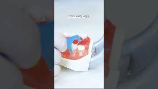 고리 치실 사용법 #치실