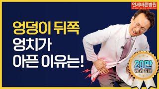 고관절 엉치통증! 엉덩이 뒤쪽 통증의 원인과 치료 ft. 이상근증후군