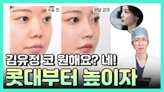 김유정처럼 예쁜 코로 만들어주세요! 3D 맞춤 보형물 활용 사례