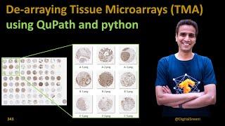 343 De-arraying Tissue Microarrays (TMA) using Qupath and python code