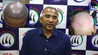 NRI Patient • Live Surgery • FUT Hair Transplant Surgery - Best Hair Transplant Clinic in World