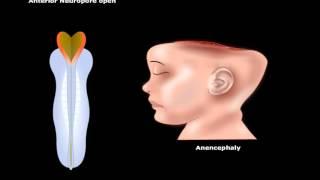 USMLE® Step 1: Neuroscience: Development of CNS Animation