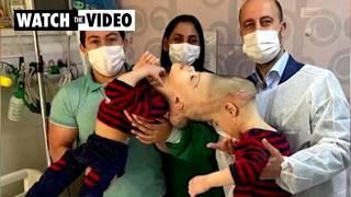 Conjoined twins share more footage from wedding #viralusa #viralvideo #youtube #trending #news #usa