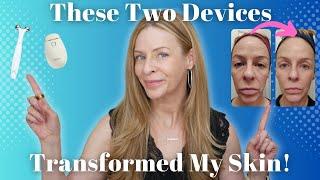 Say Goodbye to Sagging Skin!  Revisiting Two Skincare Powerhouses | Newa & Myolift