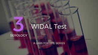 Widal test