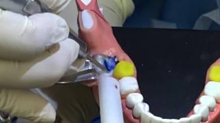 Third Molar Removal Hands-on Training