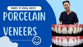 What are DENTAL VENEERS? | Things To Know Before You Get Porcelain Veneers