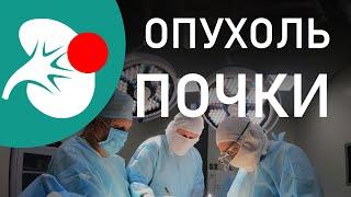 Опухоль почки. Рак почки. КТ, МРТ, биопсия. Открытая хирургия, лапароскопия, резекция, нефрэктомия