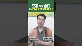 모공 vs 흉터 헷갈리면 치료 망합니다 #shorts