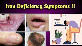 Iron Deficiency Symptoms