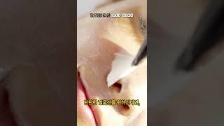[실리프팅] 수술 없이도 가능한 리프팅, 실리프팅의 매력!  | #팔자주름 #실리프팅 #피부관리