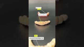 De la proteza la dinti ficsi - DELTA CLINIC DENT #shorts