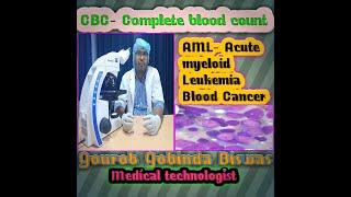 AML (acute myeloid leukemia ) cancer in Bangla. AML cancer diagnosis in Bangla. Blood Cancer.